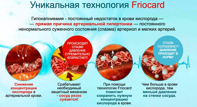 Уникальная технология Кардинео